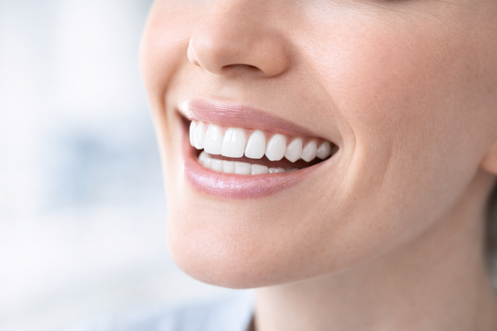 A Brighter Smile Awaits: The Power of Professional Teeth Whitening